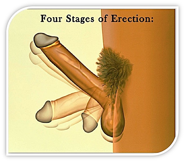 2 Four Stages of Erection